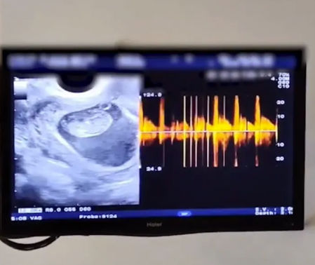 La presentadora María Casado anuncia que espera a su primer hijo