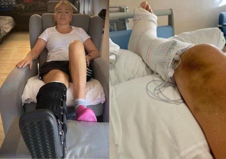 Belén Esteban después de sufrir una aparatosa caída y romperse la tibia y el peroné