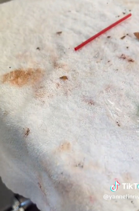 Las toallas llenas de maquillaje