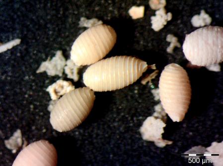 Restos de algas carófitas presentes en los sedimentos lacustres estudiados. Oósporas de estas macroalgas recubiertas de carbonato cálcico (girogonitos) .