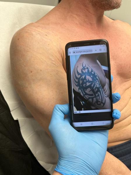 El láser de Marc Esclusa logró eliminar el trival de Jesús, repasado por cuatro tatuadores