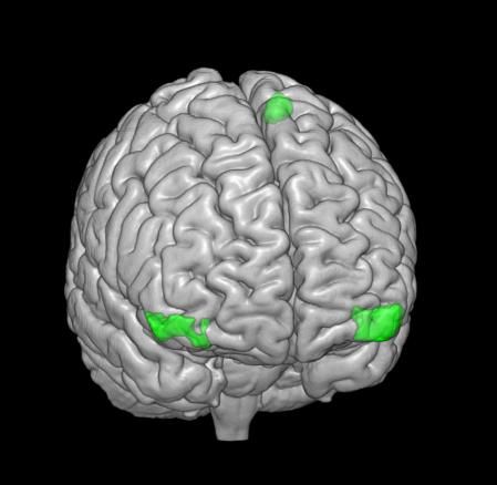 Imagen de las regiones del cerebro que responden a la lactancia materna