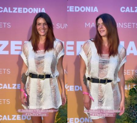 Laura Matamoros posa con la piel quemada en un evento