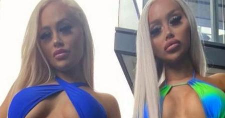 Dolly y Daisy Simpson aseguran que aún no alcanzan el aspecto deseado