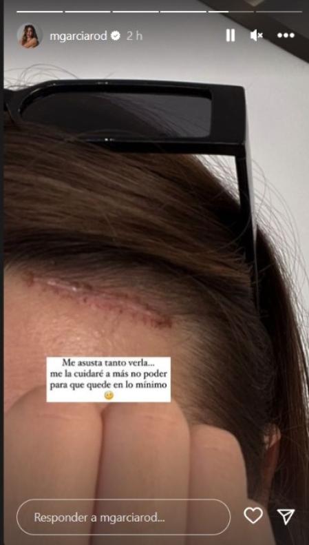 Marina García muestra su cicatriz