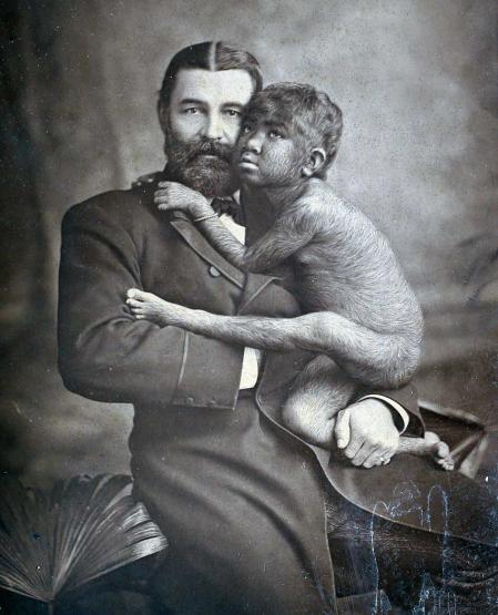 William Leonard Hunt, conocido como 'el Gran Farini', con Krao Farini, una niña con hipertricosis, 1883