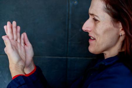 Los cambios faciales son otros de los síntomas clásicos de esta patología