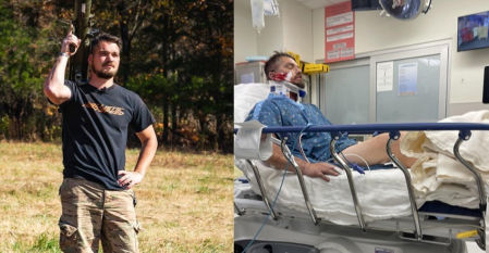 El antes y el después