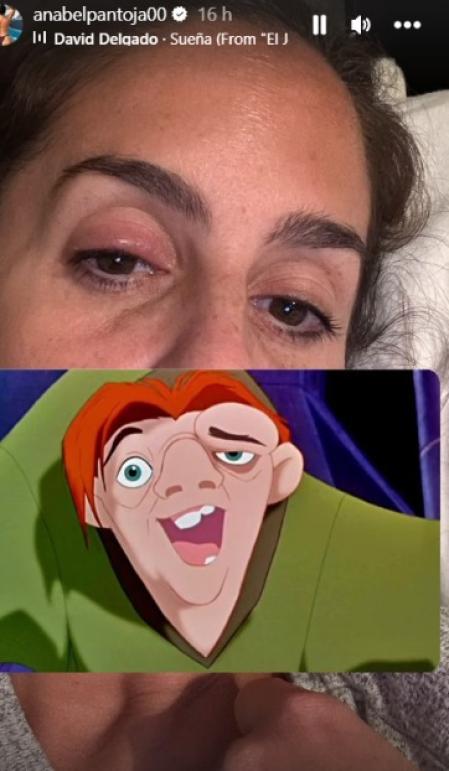 Anabel Pantoja muestra su orzuelo