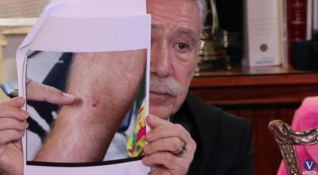 Marcos García Montes muestra imágenes de las heridas de Daniel Sancho.