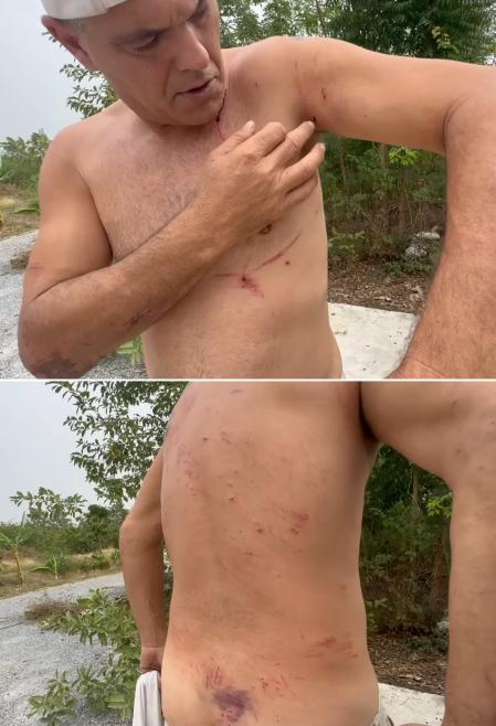 Frank Cuesta muestra sus heridas.