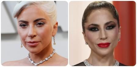 El rostro actual de Lady Gaga también podría estar reflejando el consumo de este tipo de fármacos