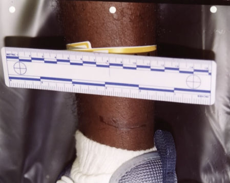 Ataduras en las víctimas de Ronald Dominique