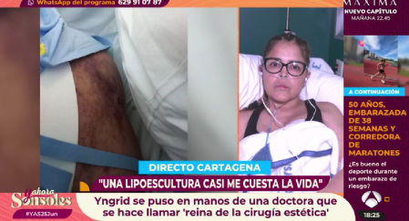 Yngrid ha acabado en la UCI por confiar en la doctora conocida en redes como 'La reina de la cirugía plástica'