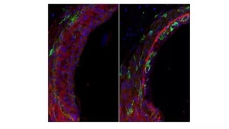 En color verde, células de inflamación en el oído interno de un ratón viejo (derecha) y de un ratón de la misma edad, pero con enfermedad de Alzheimer inducida en el laboratorio (izquierda). Fotografía original de los autores.