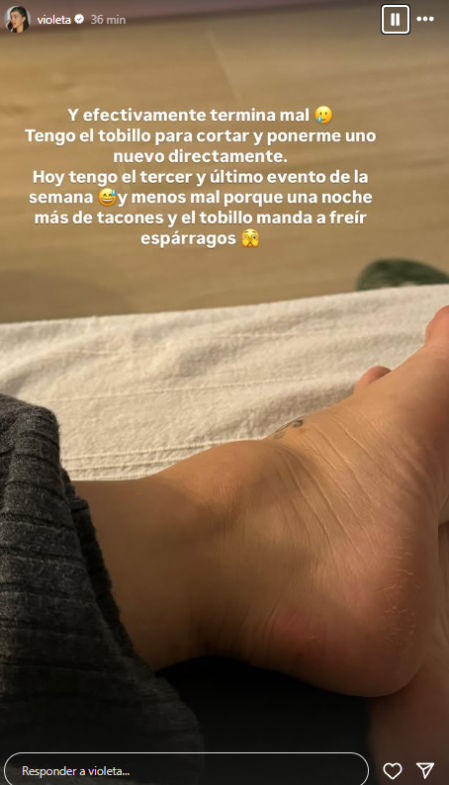 Violeta Mangriñan muestra su pie en Instagram