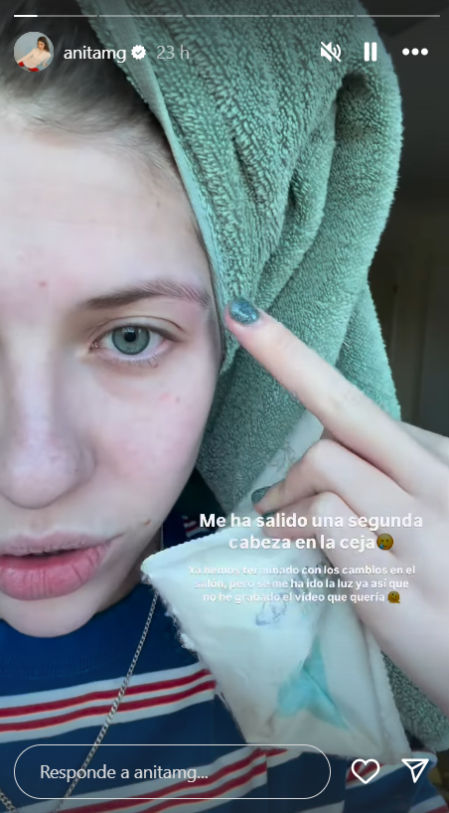 Captura del momento en que Anita Matamoros se aplica hielo en la ceja mientras relata el incidente en sus historias de Instagram
