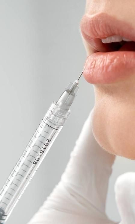 El aumento de labios con ácido hialurónico es uno de los tratamientos estéticos más demandados