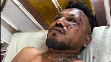 Vishwash Kumar Ramesh es el único de los 242 pasajeros del avión que ha logrado sobrevivir