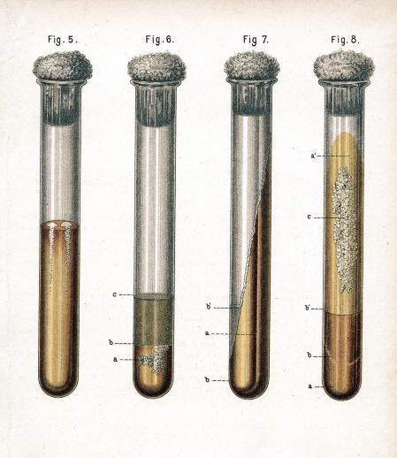 Diversos tipos de bacterias, catalogados en 1889: cultivo de neumonía (5); albúmina de un huevo podrido (6); y tuberculosis preparada por Koch (7 y 8)