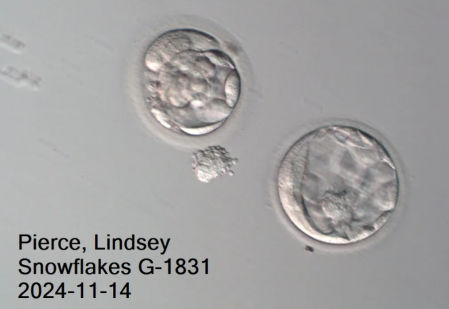 Imagen de microscopio de los embriones implantados a Lindsey Pierce, madre gestante de Thaddeus.