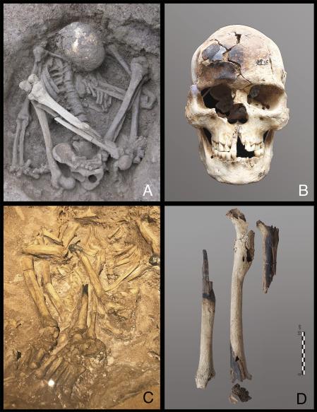 Partes de esqueletos calcinadas por el fuego&nbsp;