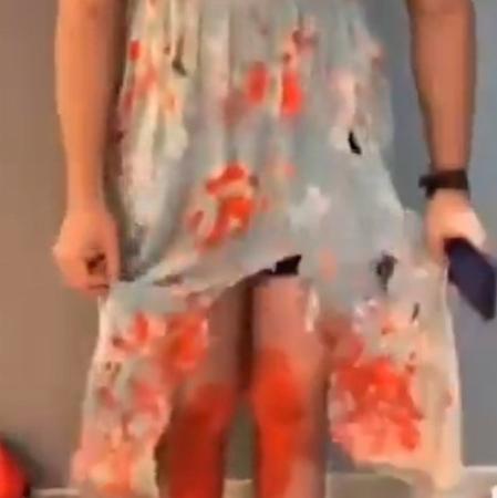 La parte de delante del disfraz de “mujer violada”, con un vestido roto y las piernas ensangrentadas