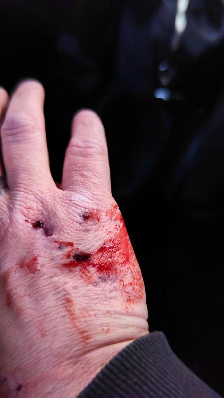 Mordeduras provocadas por Chucrute al asustarse.