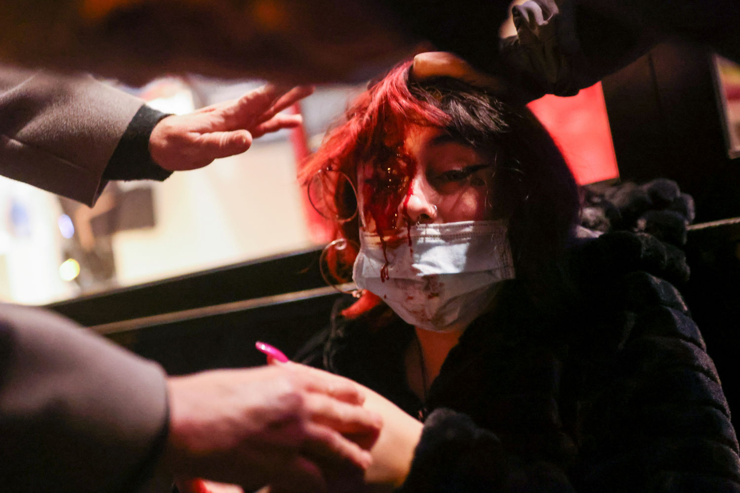 SENSITIVE MATERIAL. THIS IMAGE MAY OFFEND OR DISTURB A woman is hurt during a protest in support of Catalan rap singer Pablo Hasel, after he was given a jail sentence on charges of glorifying terrorism and insulting royalty in his songs, in Barcelona, Spain, February 16, 2021. REUTERS/Nacho Doce