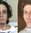 Las inspiradoras imágenes de un joven para celebrar la recuperación de su terrible adicción a las drogas