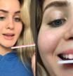 El último (y peligroso) reto viral en TikTok consiste en limarse los dientes