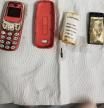 Va al hospital por fuertes dolores de estómago y descubre que se ha tragado un Nokia 3310