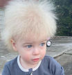 Este niño sufre un raro síndrome que hace que su pelo sea imposible de peinar