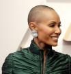 Qué es la alopecia femenina, la afección que padece Jada Pinkett Smith | Corpore Sano
