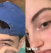 La cicatriz francesa, el absurdo y peligroso reto en TikTok entre jóvenes que se autolesionan los pómulos