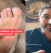 Un farmacéutico explica la mejor manera de cortarse las uñas de los pies: "Mejor limar que cortar, pero..."