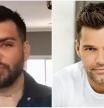 Se opera más de 30 veces para parecerse a Ricky Martin y el resultado es un desastre