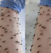Así le han dejado el brazo cientos de mosquitos tras un experimento: "Donación de sangre"