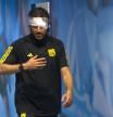 Fabio Grosso, herido y vendado, en la enfermería del estadio del Marsella, este domingo