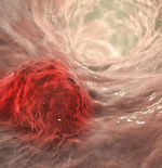 ¿Nueva terapia celular para combatir el cáncer de manera más efectiva?