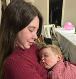 “Mi hija de un año tiene piel de mariposa, nunca le hemos podido destapar las piernas; cada roce es una ampolla”