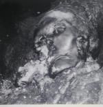 Una mujer siberiana de hace 2.500 años recibió la primera prótesis bucal de la historia tras una compleja cirugía en la mandíbula