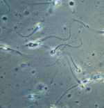 Identificados en el semen humano 42 compuestos químicos de uso cotidiano