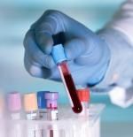 ¿Un análisis de sangre podrá mejorar el tratamiento del cáncer?