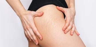 Cuida tu piel este 2025 con estas cremas hidratantes para tratar estrías y cicatrices.