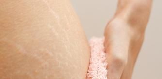 El producto antiestrías que tu cuerpo necestia para hidratar la piel y mantener su elasticidad.