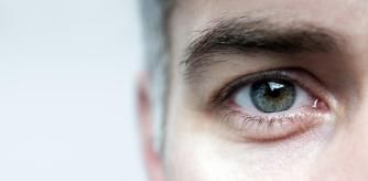 Un hombre con bolsas en los ojos