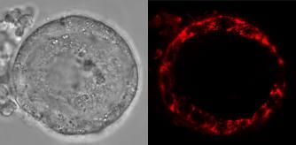 Imagen de un folículo humano