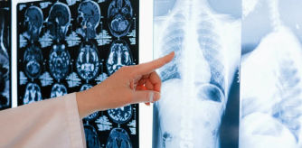 La mujer acudió hasta 26 al médico sin que le detectaran el cáncer