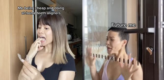 Los dentistas advierten sobre la peligrosa moda de TikTok de comprar en Internet alineadores para dientes